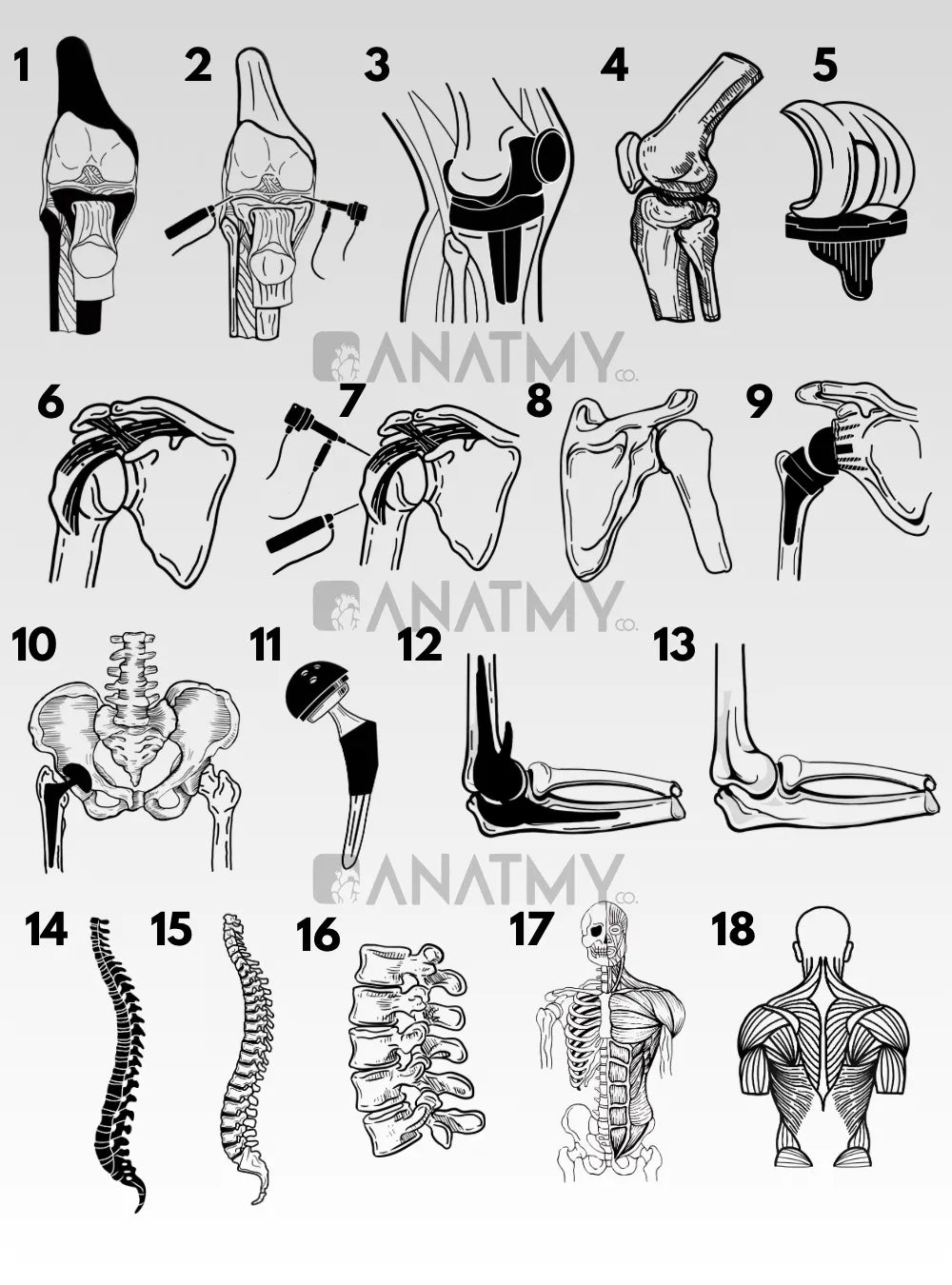 CUADROS TRAUMATOLOGÍA Y ORTOPEDIA - imagen 2