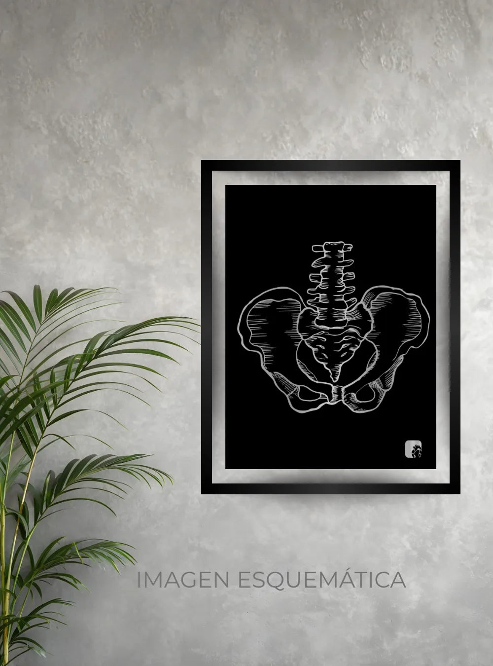 CUADROS TRAUMATOLOGÍA Y ORTOPEDIA - imagen 5