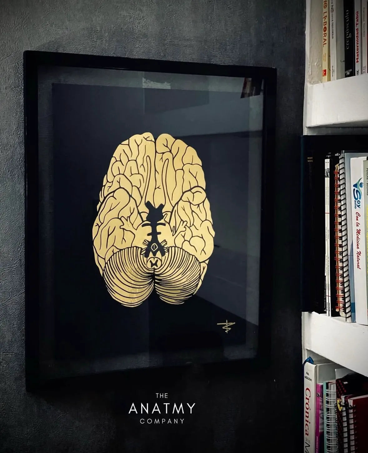 Cuadro Neurología variante